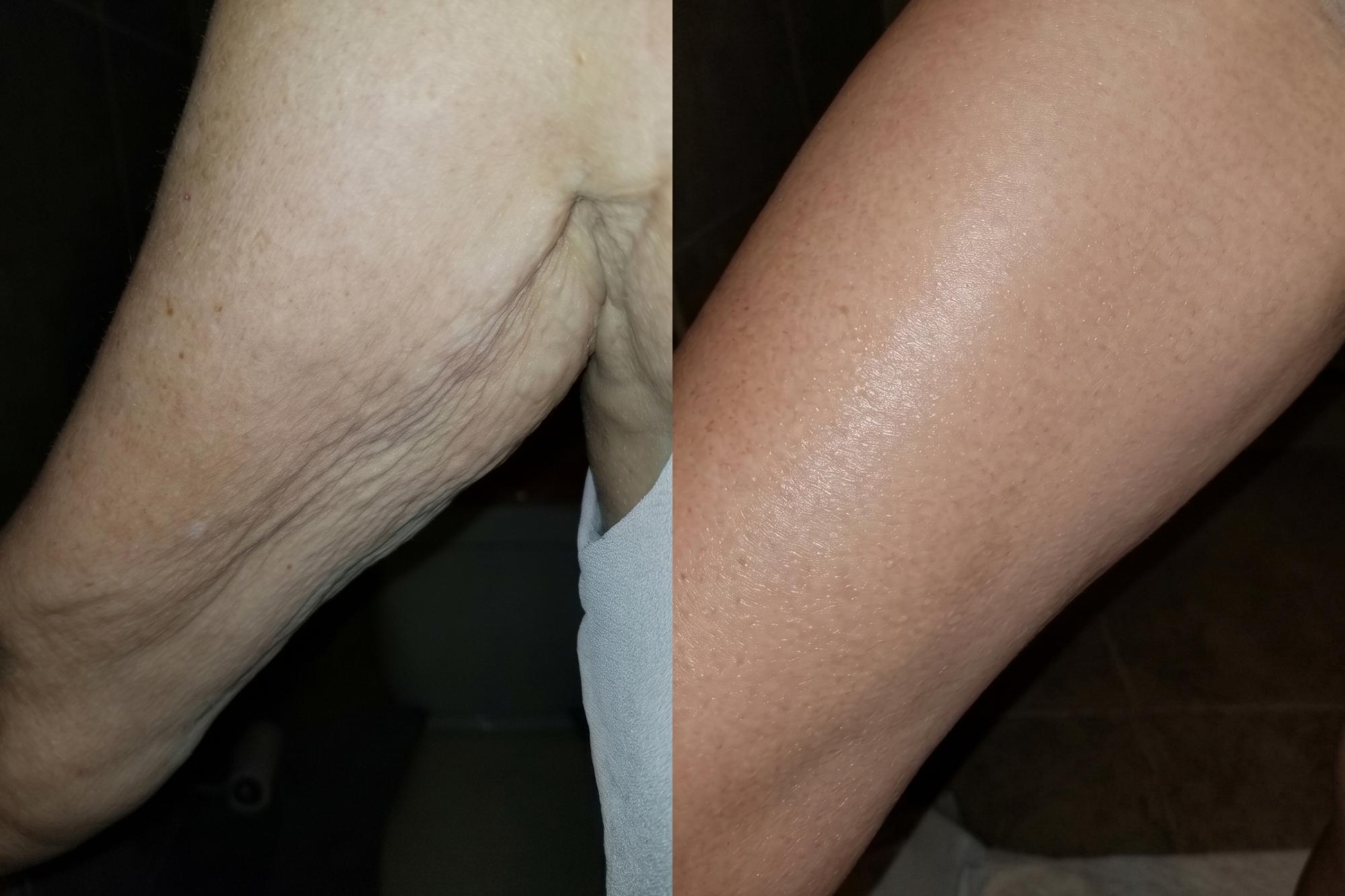 Firmer, smoother skin results after using Cavo Glow Body Oil